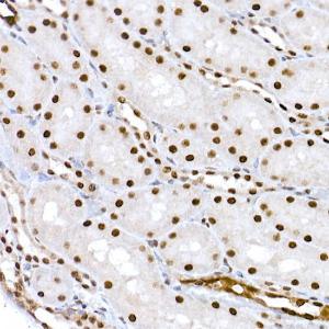 Immunohistochemistry analysis of paraffin-embedded rat kidney using Anti-CREB (phospho Ser133) Antibody (A10868) at a dilution of 1:100 (40x lens). Perform high pressure antigen retrieval with 10 mM citrate buffer pH 6.0 before commencing with IHC staining protocol.