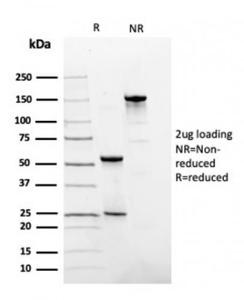 SDS-PAGE analysis of Anti-Fibronectin Antibody [FN1/3036] under non-reduced and reduced conditions; showing intact IgG and intact heavy and light chains, respectively. SDS-PAGE analysis confirms the integrity and purity of the antibody