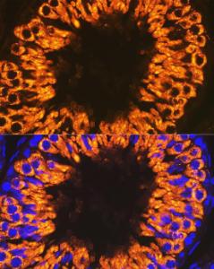 Immunofluorescence analysis of rat testis cells using Anti-Calmegin Antibody [ARC2214] (A305871) at a dilution of 1:100 (40X lens). DAPI was used to stain the cell nuclei (blue)