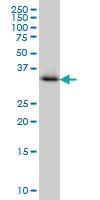 Anti-CRYM Mouse Monoclonal Antibody [clone: 6B3]