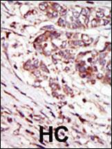 Anti-CAMK1G Rabbit Polyclonal Antibody (AP (Alkaline Phosphatase))