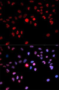 Immunofluorescence analysis of MCF-7 cells using Anti-CREB (phospho Ser133) Antibody (A10868). DAPI was used to stain the cell nuclei (blue).