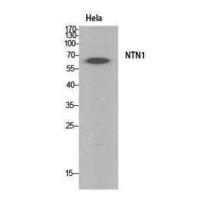 Western blot analysis of HeLa cells using Anti-NTN1 Antibody