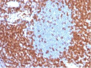 Immunohistochemical analysis of formalin-fixed, paraffin-embedded human tonsil tissue using Anti-CD3 epsilon Antibody [C3e/4653R] at 2 µg/ml