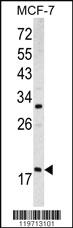 Anti-ARF3 Rabbit Polyclonal Antibody