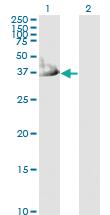 Anti-CRYM Mouse Monoclonal Antibody [clone: 6B3]