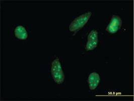 Anti-RPS6KA2 Mouse Monoclonal Antibody [clone: 1F6]