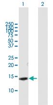 Anti-SLPI Mouse Polyclonal Antibody