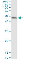 Anti-MECR Rabbit Polyclonal Antibody