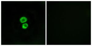 Immunofluorescence analysis of MCF7 cells using Anti-IFM3 Antibody. The right hand panel represents a negative control, where the antibody was pre-incubated with the immunising peptide