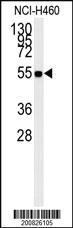 Anti-ALDH1A1 Mouse Monoclonal Antibody