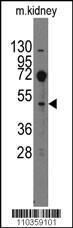 Anti-EVX2 Rabbit Polyclonal Antibody (AP (Alkaline Phosphatase))