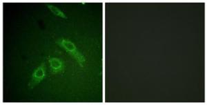 Immunofluorescence analysis of HepG2 cells using Anti-FAK (phospho Ser910) Antibody. The right hand panel represents a negative control, where the antibody was pre-incubated with the immunising peptide.