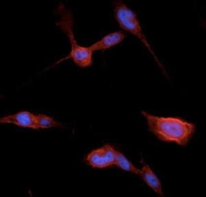 BEAS-2B cells, fixed with 4% PFA, stained with Anti-beta Catenin Antibody at a 1:250 dilution