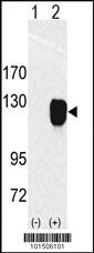 Anti-ROR1 Rabbit Polyclonal Antibody