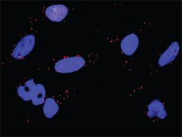 Anti-RPS6KA2 Mouse Monoclonal Antibody [clone: 1F6]