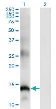 Anti-SLPI Mouse Monoclonal Antibody [clone: 3C6]