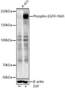 Western blot analysis of A-431, using Anti-EGFR (phospho Tyr845) Antibody (A10871) at 1:2,000 dilution A-431 cells were treated by EGF (100 ng/ml) at 37°C for 30 minutes after serum-starvation overnight