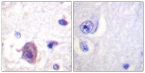 Immunohistochemical analysis of paraffin-embedded human brain using Anti-FAK (phospho Ser910) Antibody. The right hand panel represents a negative control, where the antibody was pre-incubated with the immunising peptide.