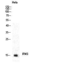 Western blot analysis of various cells using Anti-IFM3 Antibody