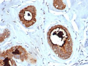 Immunohistochemical analysis of formalin-fixed, paraffin-embedded human lactating breast using Anti-Mammaglobin A Antibody [rMGB/6619]