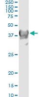 Anti-CRYM Mouse Monoclonal Antibody [clone: 6B3]