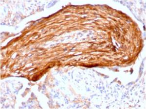 Immunohistochemical analysis of formalin-fixed, paraffin-embedded human lung using Anti-Fibronectin Antibody [FN1/3045]