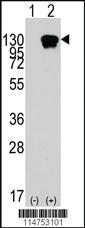 Anti-ROR1 Rabbit Polyclonal Antibody