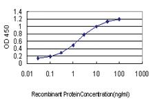 Anti-CRYM Mouse Monoclonal Antibody [clone: 6B3]