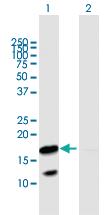 Anti-VNN3 Mouse Polyclonal Antibody