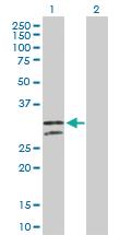 Anti-NUDT6 Rabbit Polyclonal Antibody