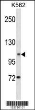 Anti-ANO1 Rabbit Polyclonal Antibody (APC (Allophycocyanin))