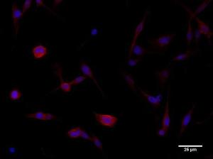 BEAS-2B cells, fixed with 4% PFA, stained with Anti-beta Catenin Antibody at a 1:250 dilution