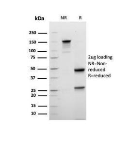 SDS-PAGE analysis of Anti-Mammaglobin A Antibody [rMGB/6619] under non-reduced and reduced conditions; showing intact IgG and intact heavy and light chains, respectively. SDS-PAGE analysis confirms the integrity and purity of the antibody