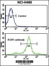 Anti-ROR1 Rabbit Polyclonal Antibody