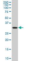 Anti-CRYM Mouse Monoclonal Antibody [clone: 1C6]