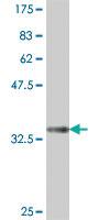 Anti-SEPT15 Mouse Polyclonal Antibody