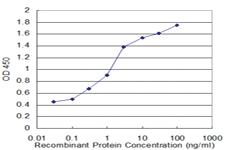 Anti-CRYM Mouse Monoclonal Antibody [clone: 1C6]