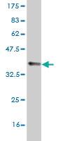 Anti-SCN8A Mouse Monoclonal Antibody [clone: 4G7]