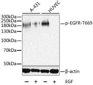 Antibody anti-EGFR phospho T669 100 µl