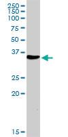 Anti-NUDT6 Rabbit Polyclonal Antibody