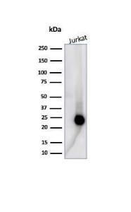 Western blot analysis of human Jurkat cell lysate using Anti-CD3 epsilon Antibody [C3e/4653R]