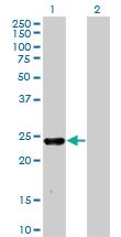 Anti-MXI1 Mouse Monoclonal Antibody [clone: 1F3]