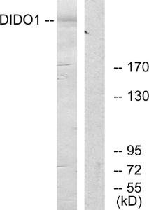 Western blot analysis of lysates from 293 cells using Anti-DIDO1 Antibody. The right hand lane represents a negative control, where the antibody is blocked by the immunising peptide.