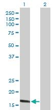 Anti-CLDN1 Mouse Polyclonal Antibody