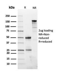 SDS-PAGE analysis of Anti-Fibronectin Antibody [FN1/3045] under non-reduced and reduced conditions; showing intact IgG and intact heavy and light chains, respectively. SDS-PAGE analysis confirms the integrity and purity of the antibody.