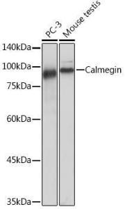 Western blot analysis of extracts of various cell lines, using Anti-Calmegin Antibody [ARC2213] (A305872) at 1:1,000 dilution. The secondary antibody was Goat Anti-Rabbit IgG H&L Antibody (HRP) at 1:10,000 dilution.