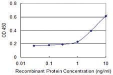 Anti-HLA-DQB1 Mouse Monoclonal Antibody [clone: 1G6]