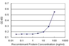 Anti-C17ORF75 Antibody Pair