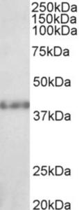 EB05731 (1 µg/ml) staining of Rat Kidney lysate (35 µg protein in RIPA buffer). Primary incubation was 1 hour. Detected by chemiluminescence.